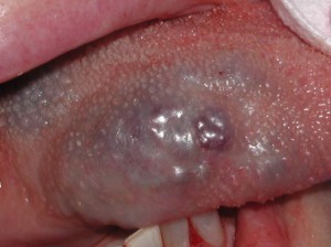 Figure 1. Pre-Operative.