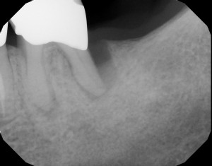 case5