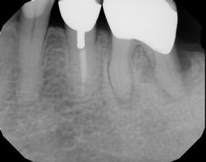 case5b